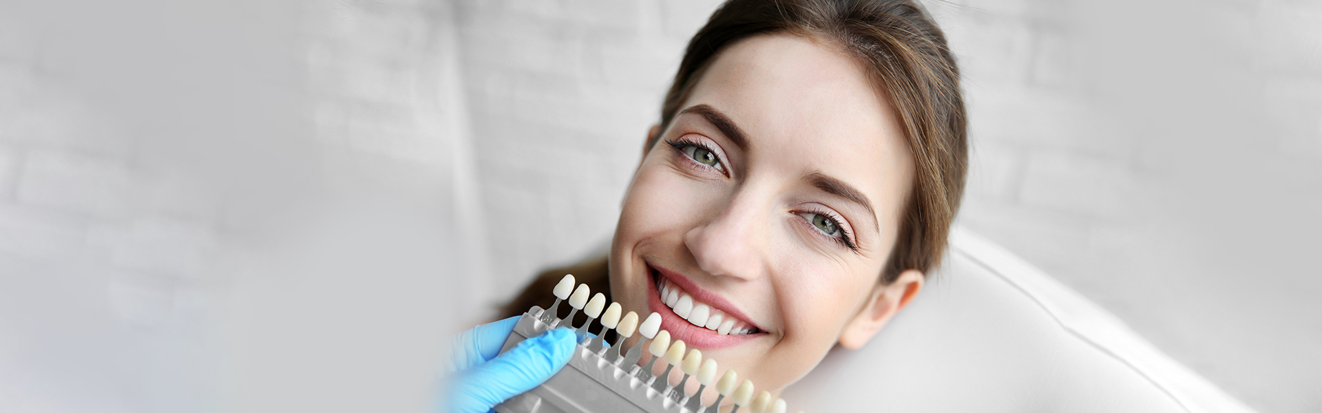 The Advantages of Dental Veneers