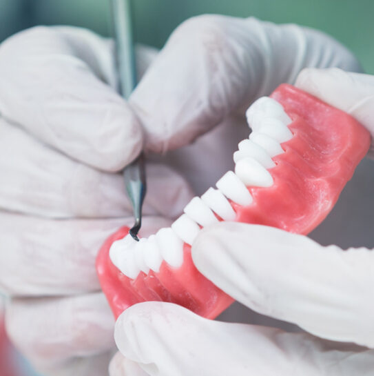 Removable Dentures