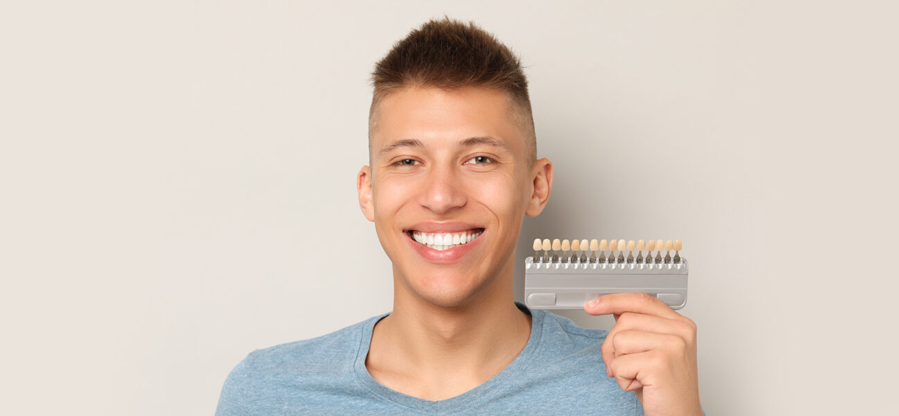Veneers and Laminates